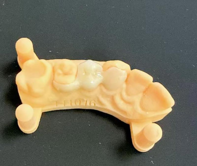 Mida peate Marylandi sildade kohta teadma?