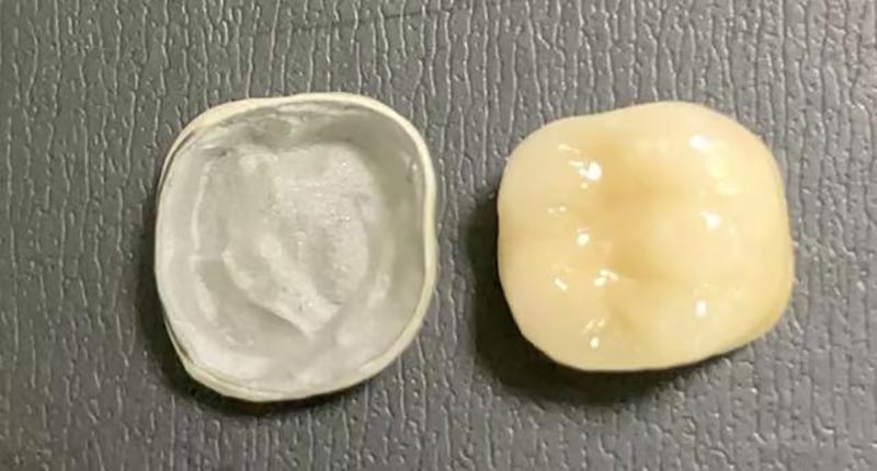 WM DENTAL LAB – juhtiv Hiina hambalabor