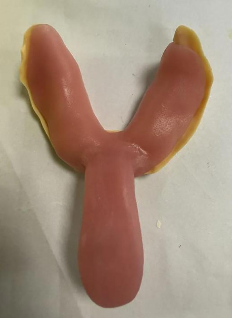 Asjad, mida te kohandatud hambaraviplaatide kohta ei teadnud