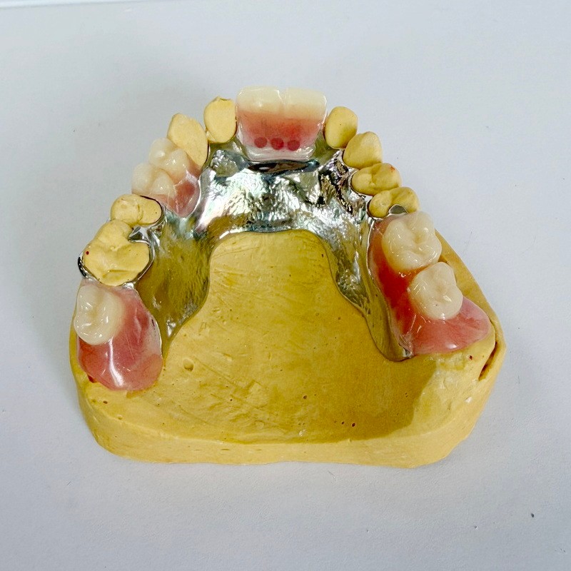 Eemaldatav taastamise osaline karkass